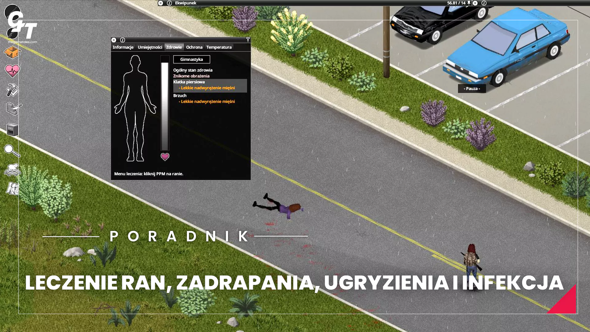 Jak sprawdzić rany, infekcje i ugryzienia postaci w Project Zomboid i jak je wyleczyć