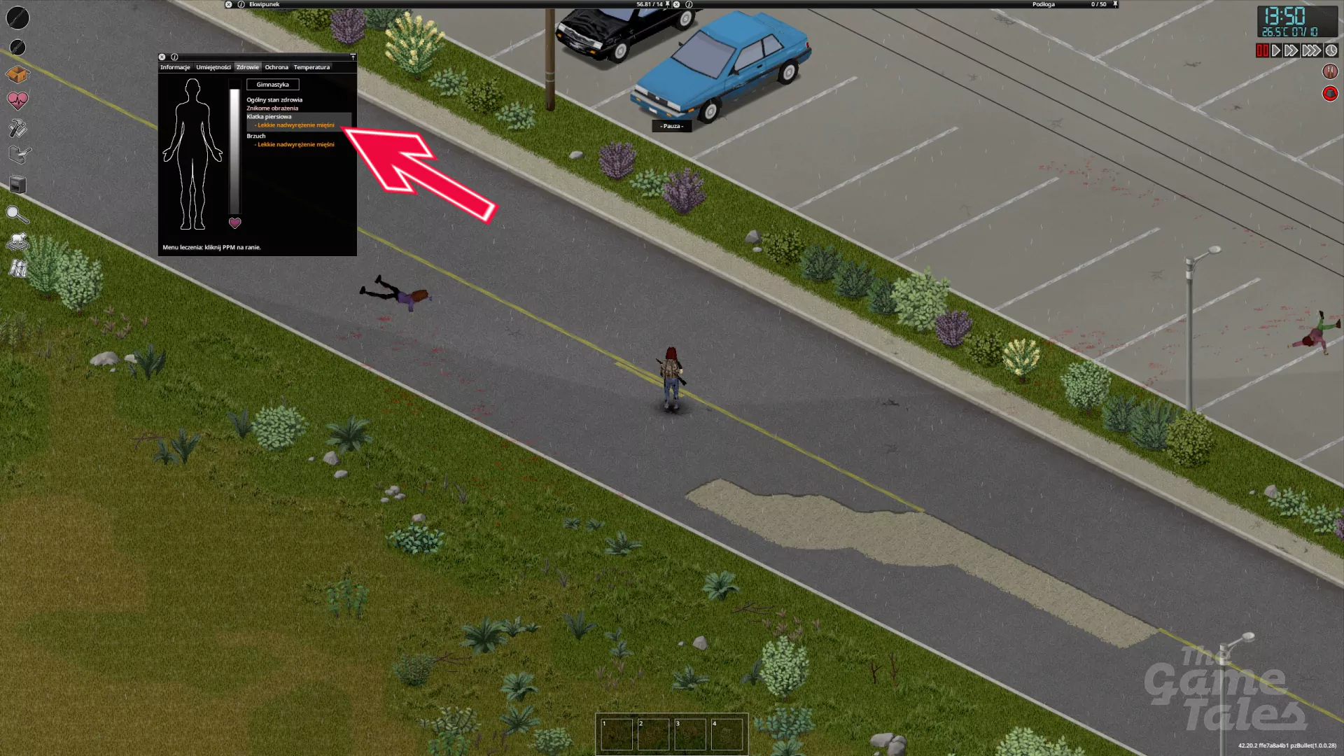 Jak sprawdzić rany, infekcje i ugryzienia postaci w Project Zomboid i jak je wyleczyć